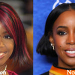 Kelly Rowland Plastic Surgery Before and After Photos
