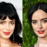 Krysten Ritter Plastic Surgery Before and After Photos