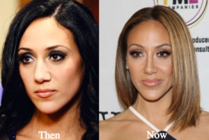melissa-gorga-plastic-surgery-before-and-after-nose-job-photo - Latest