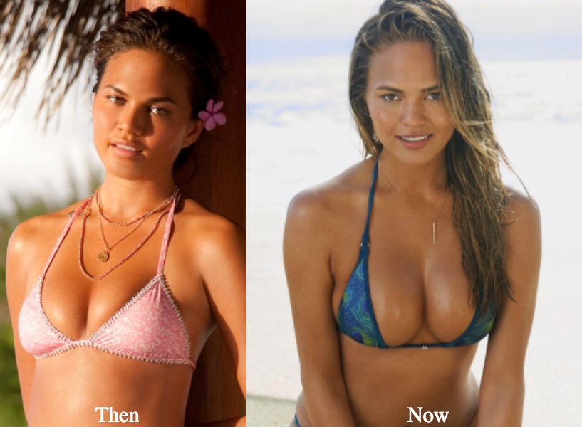 Chrissy Teigen has one breast larger than the other - 8days