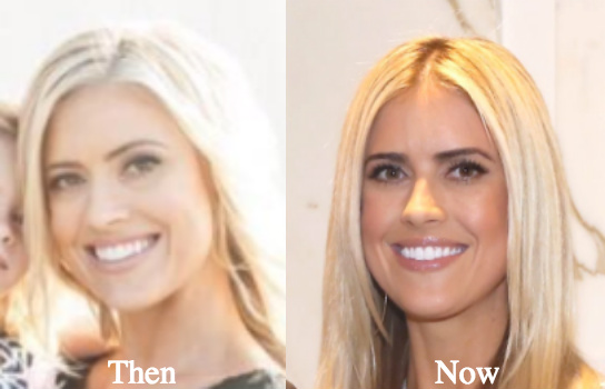 christina-el-moussa-plastic-surgery-rumors-before-and-after-photos - Latest...