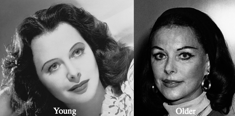 Hedy Lamarr botox before and after - Latest Plastic Surgery Gossip And News...