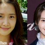 Yoona Plastic Surgery Before and After Photos