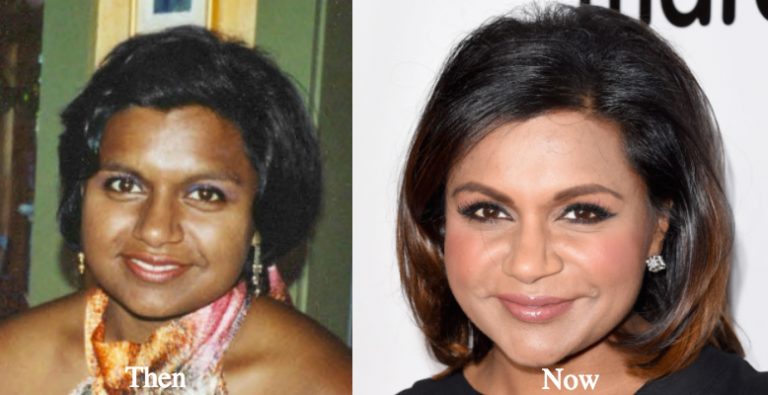 mindy kaling nose job Image 2