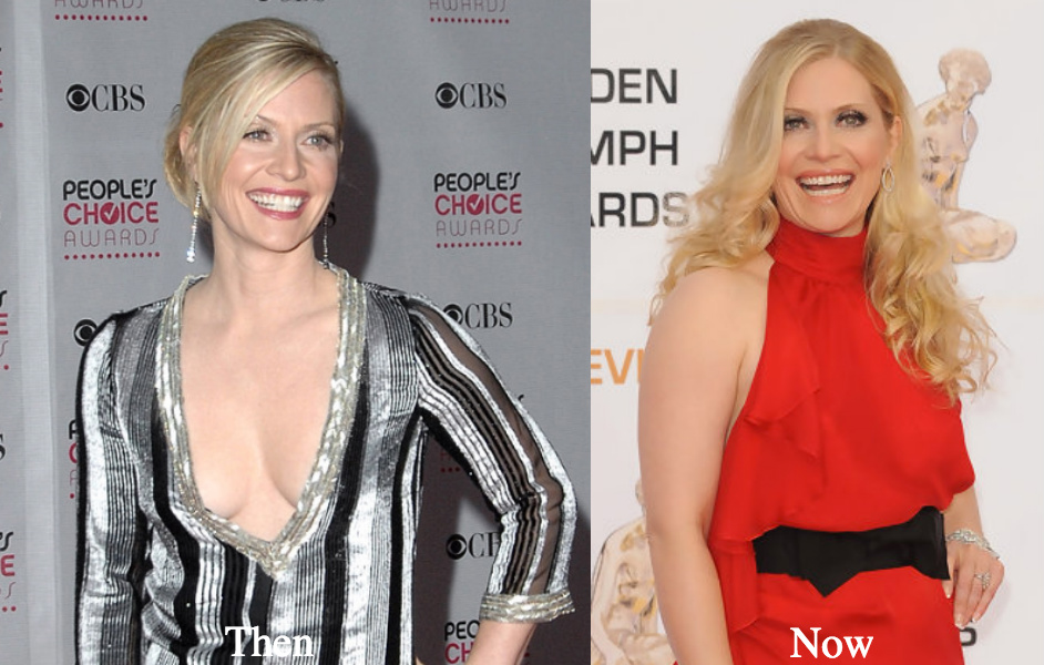 Emily Procter Boob job before and after photos - Latest Plastic Surgery Gos...