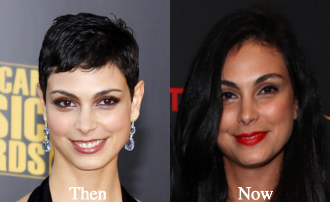 Morena Baccarin boobs plastic surgery before and after photos - Latest Plas...