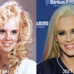 Jenny McCarthy Plastic Surgery Before and After Photos