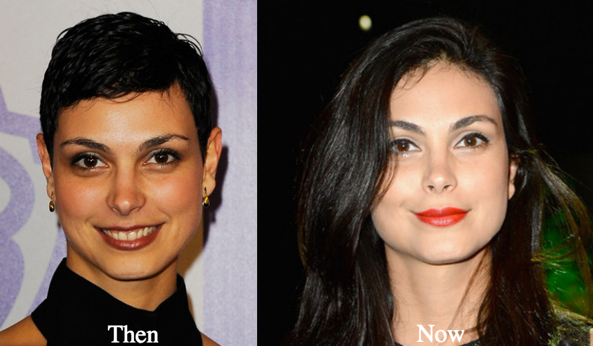 morena baccarin botox now and then photos - Latest Plastic Surgery Gossip A...