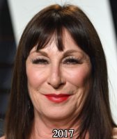 Anjelica Huston Plastic Surgery Before and After Photos - Awful ...