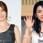 Yoo In Na Plastic Surgery Before and After Photos