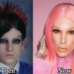 Jeffree Star Plastic Surgery Before and After Photos