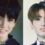 Jungkook Plastic Surgery Before and After Photos