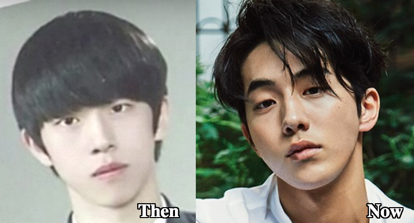 Nam Joo Hyuk nose job before and after photos.