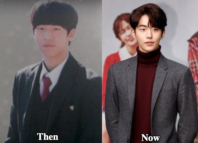 Nam Joo Hyuk Plastic Surgery Before And After Photos - Latest Plastic  Surgery Gossip And News. Plastic Surgery Tips And Advice