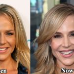 Julie Benz Plastic Surgery Before and After Photos