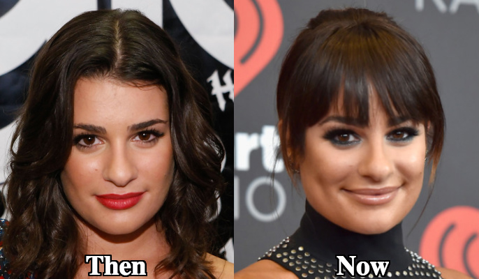 Lea Michele nose shape surgery.