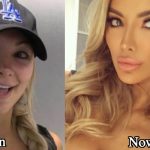 Lindsey Pelas Plastic Surgery Before and After Photos