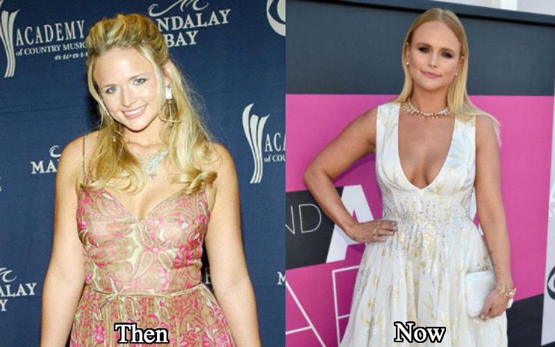 Miranda Lambert boob job before and after photos.