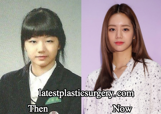 Did Hyeri Undergo Plastic Surgery? 