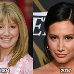 Ashley Tisdale Nose Job Before and After Photos