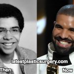 Drake Nose Job Rumors – True or False?