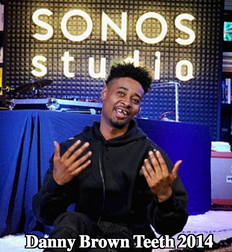 Danny Brown and His Teeth - Did He Fix Them? 