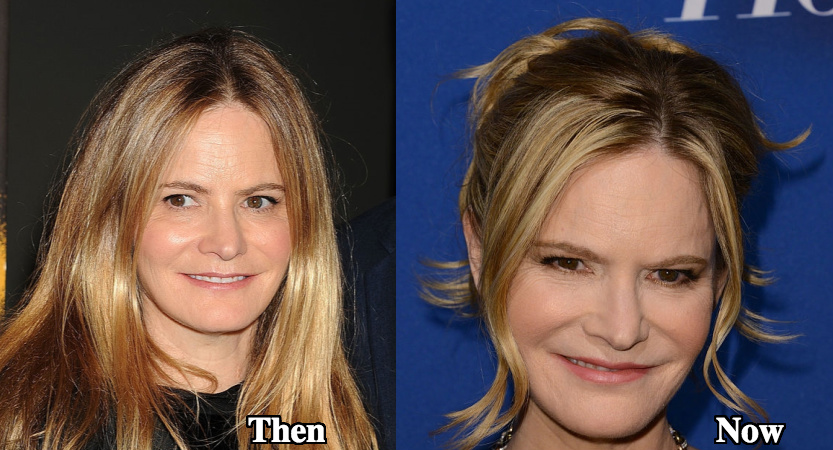 Jennifer Jason Leigh Plastic Surgery Before and After Photos Jennifer Jason...