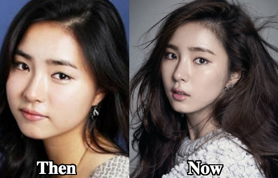 Another popular plastic surgery allegation about Shin Se Kyung is jawline s...